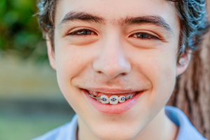 Braces repair